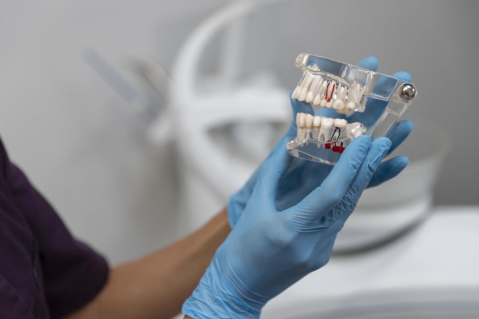 Tratamento de Implantes Dentários na Ortoland Odontologia